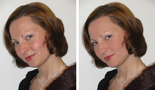 Рис. 5. Исходное изображение (слева) и результат удаления изъянов кожи лица 